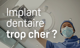 implants dentaires