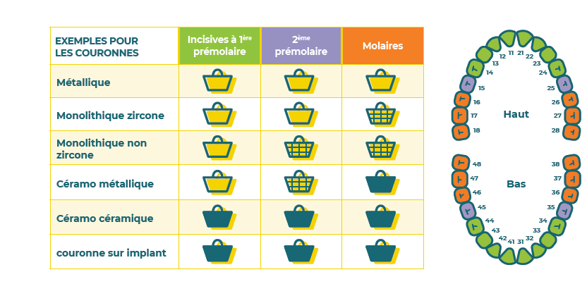 Couronnes dentaires